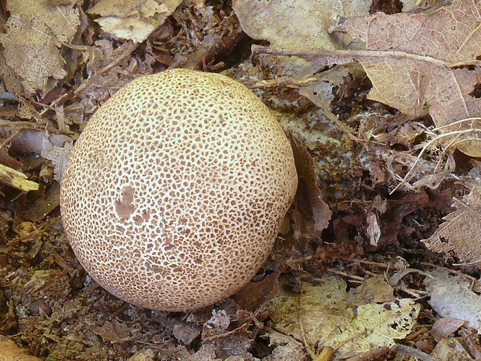 Sleroderma Areolatum